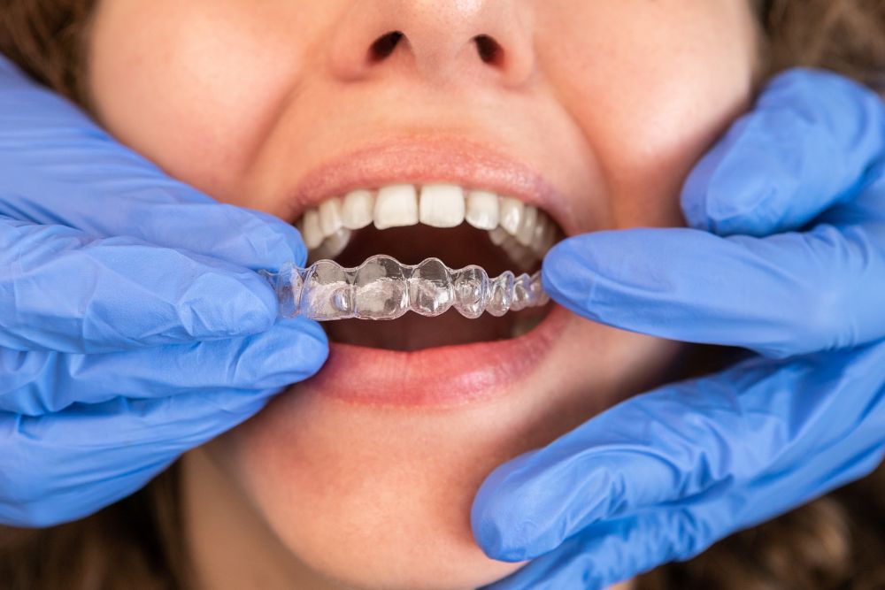 Is Invisalign Painful