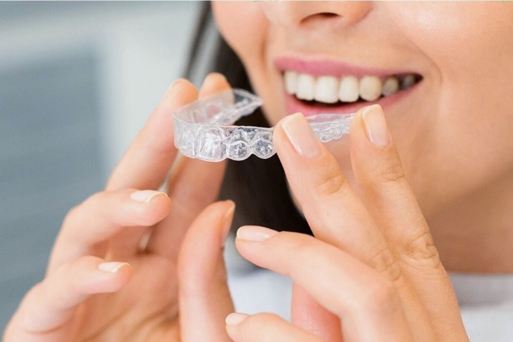 Why Invisalign in Brandon Is the Best Alternative to Braces