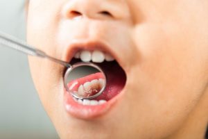 Why Parents Choose Dental Theory for Kids Dental Near Me